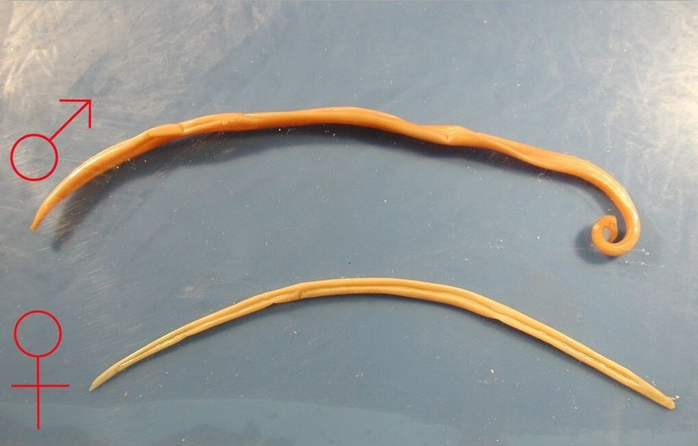 roundworm from the human body