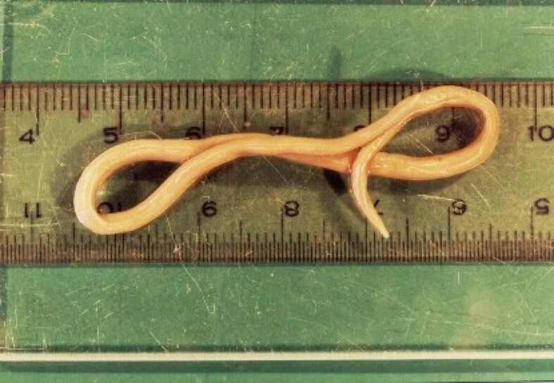 roundworm parasite from the human body