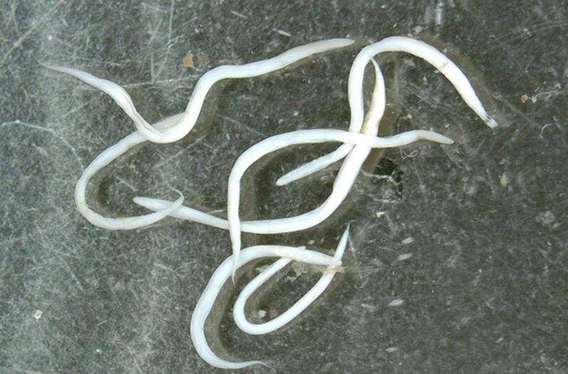 worm parasite from the human body