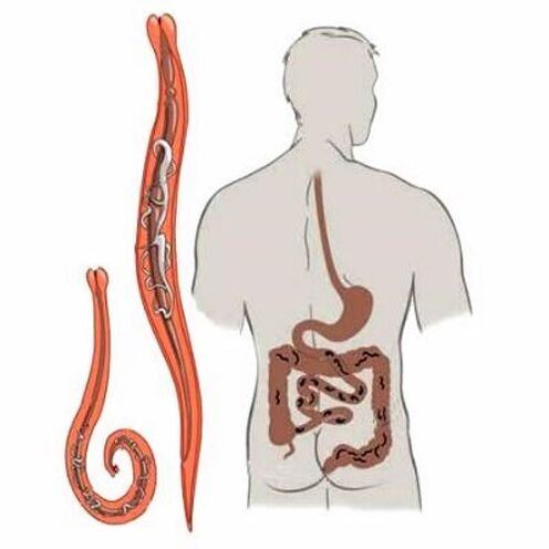 worms in the human intestines