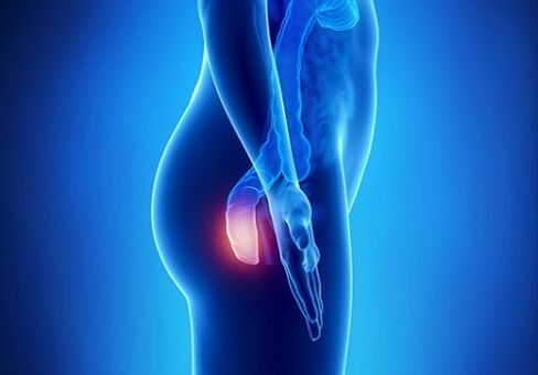 itching in the rectum as an indication for testing for parasites