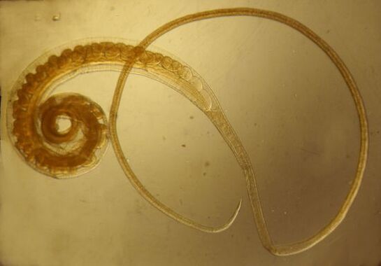 Trichinella worm from the human body
